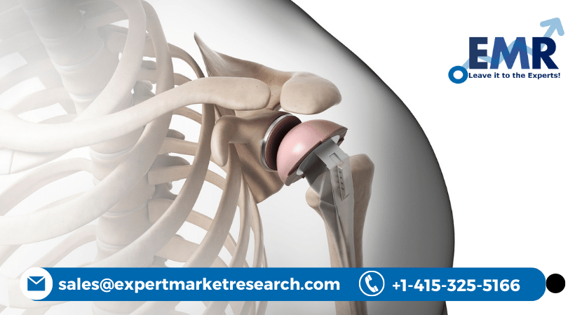 Global Shoulder Replacement Market Share, Size, Trends, Price, Report and Forecast Period Of 2023-2028