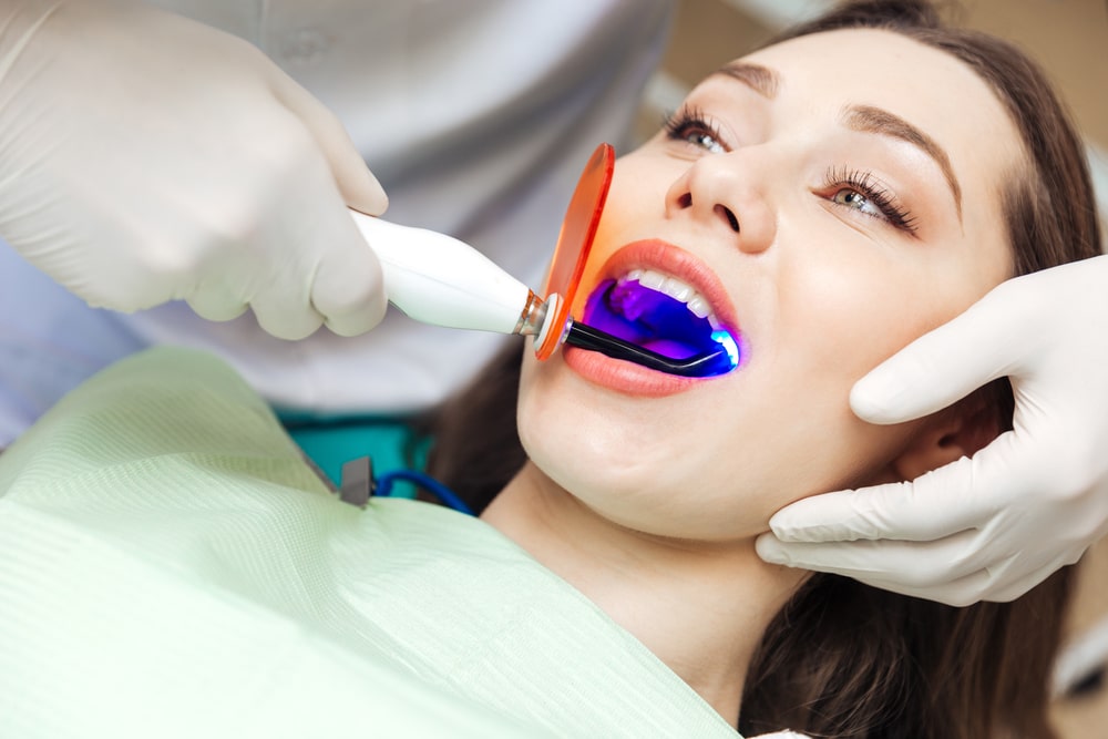 Lumineers Teeth in Dubai: Transform Your Smile with Painless