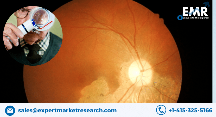 Global Age-Related Macular Degeneration (AMD) Market Share, Size, Trends, Price, Report and Forecast Period Of 2023-2028