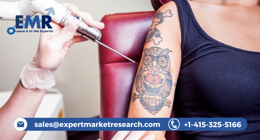 Global Tattoo Removal Market Share, Size, Trends, Analysis, Report and Forecast Period Of 2023-2031